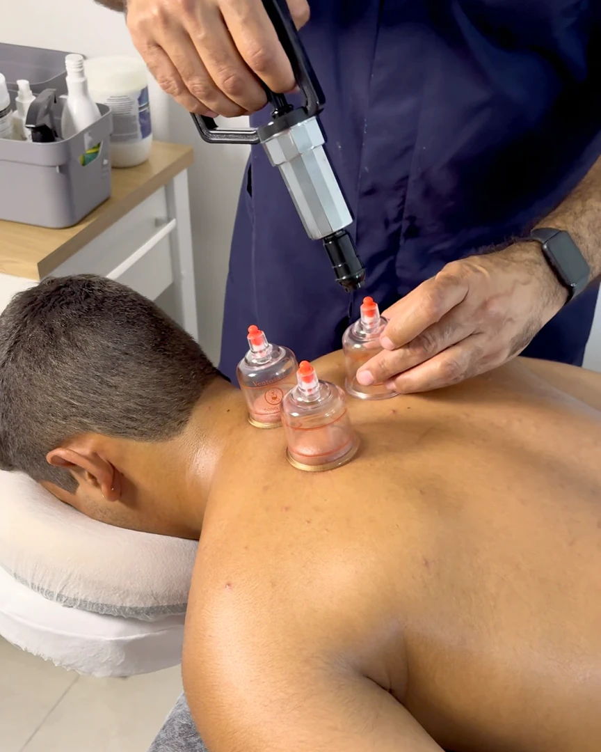 Ventosaterapia andre rocha